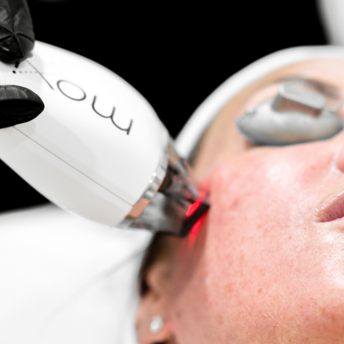 Featured image for Advanced Laser Treatments