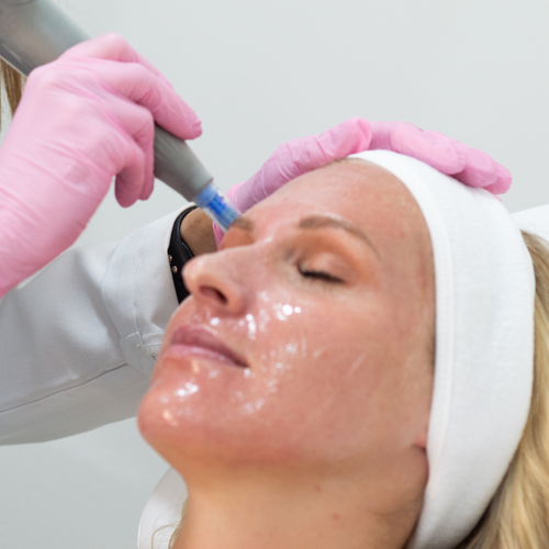 Featured image for Microneedling